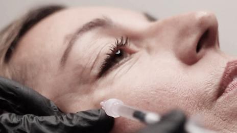 Errores comunes en medicina estética que debes evitar