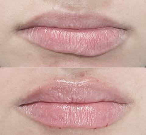 labios